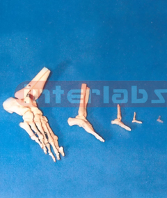 ADULT FOOT BONE WITH A PORTION OF THE TIBIA AND FIBULA